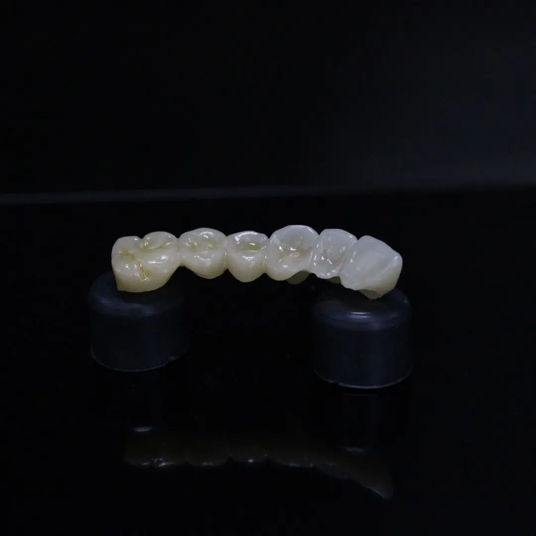 Puente de 6 unidades en zirconia multicapa fabricado en 3DigitaLab